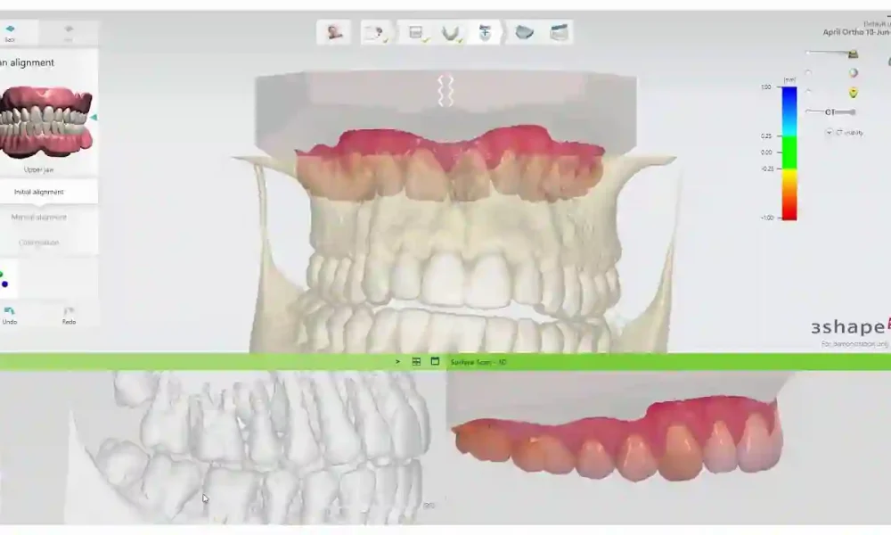 Import 3shape Scans Into Exocad